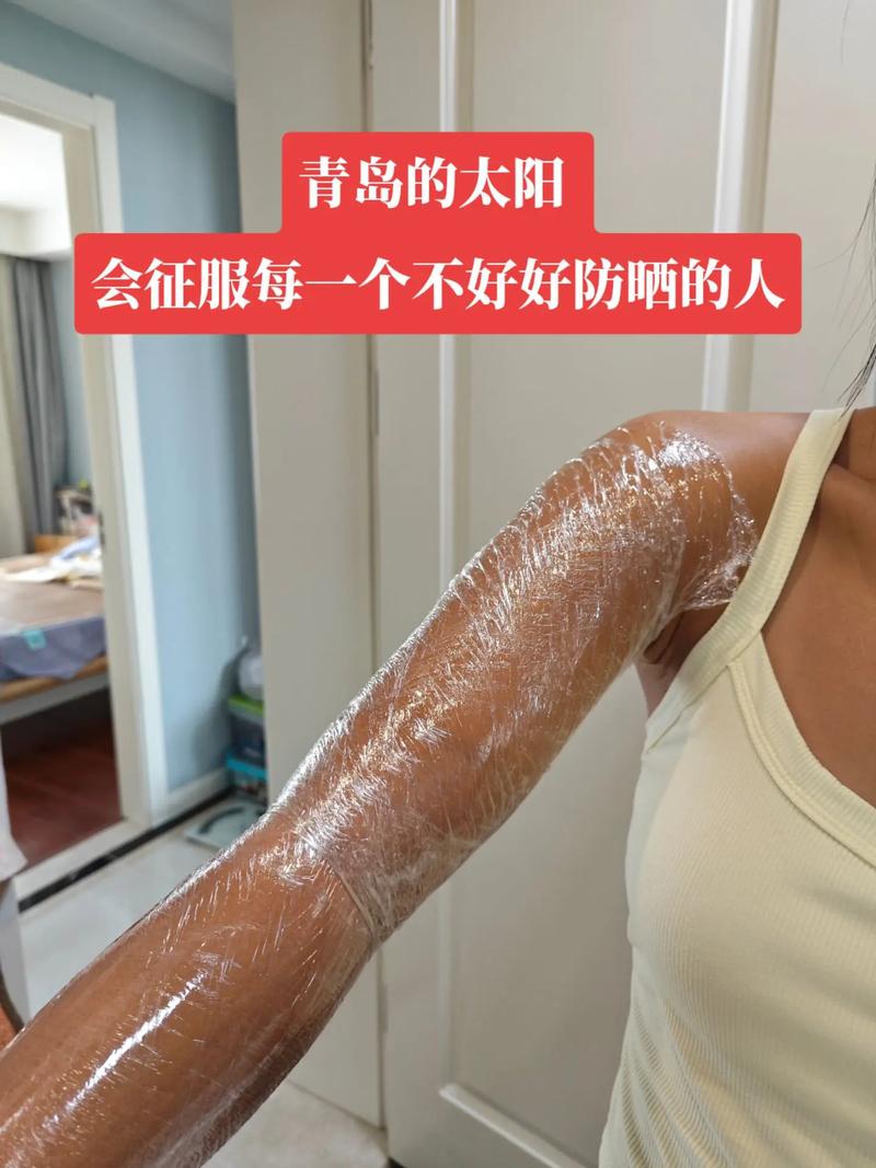 晒黑后能白回来吗?